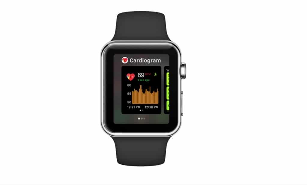cardigram Apple watch diabète tension artérielle