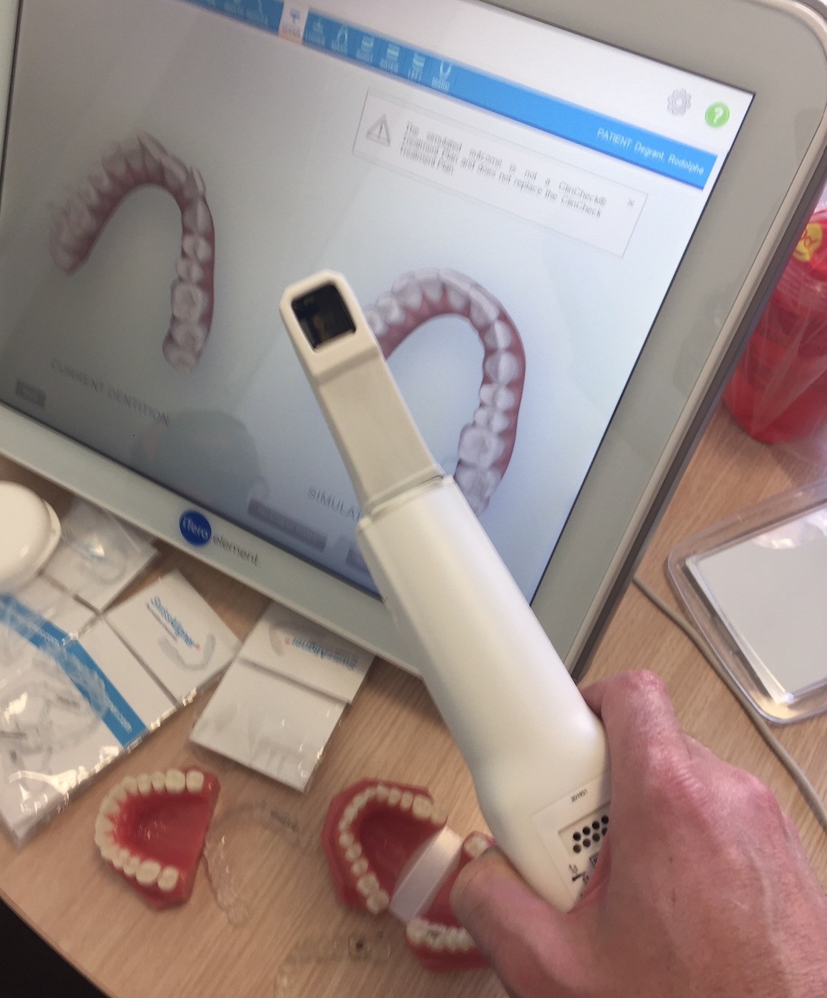 Swissaligner avis appareil scan 3D dentition